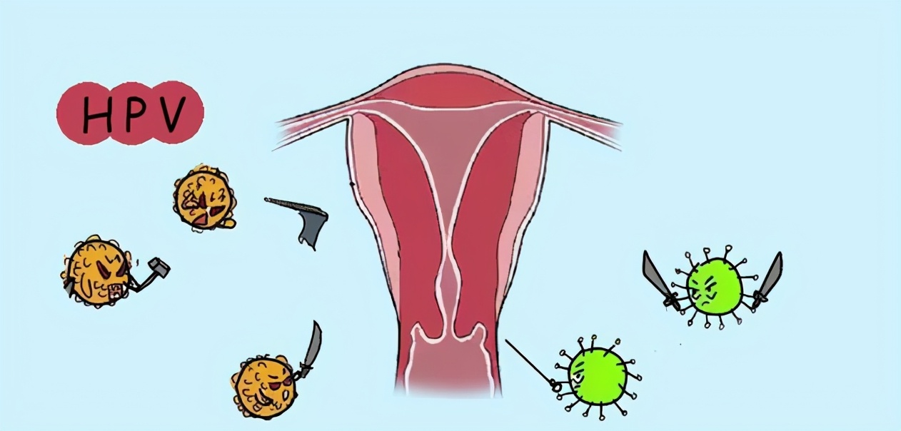 大学生感染hpv,半年转阴,医生直言:小姑娘的做法值得学习