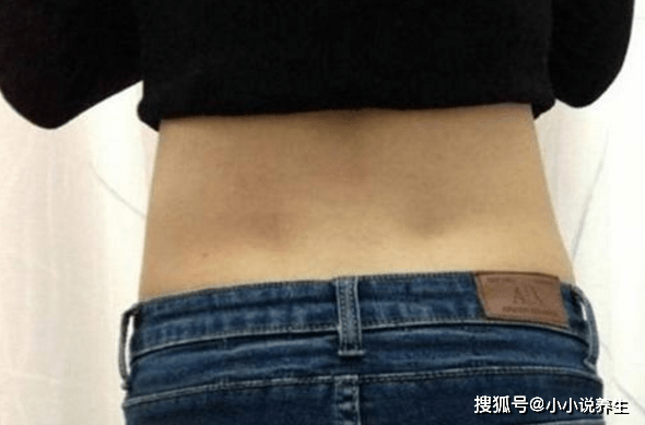 女性后腰的2个"凹点"是什么?为何只有少数人有?别害羞