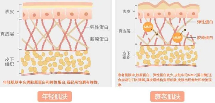 同时,植入的胶原蛋白能够刺激体内自身胶原蛋白再生,重整肌肤纤维组织