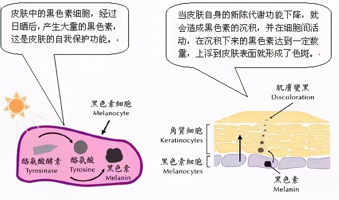 而这种黑色素颗粒来源于体内 酪氨酸,在 酪氨酸酶的催化下氧化,聚合而