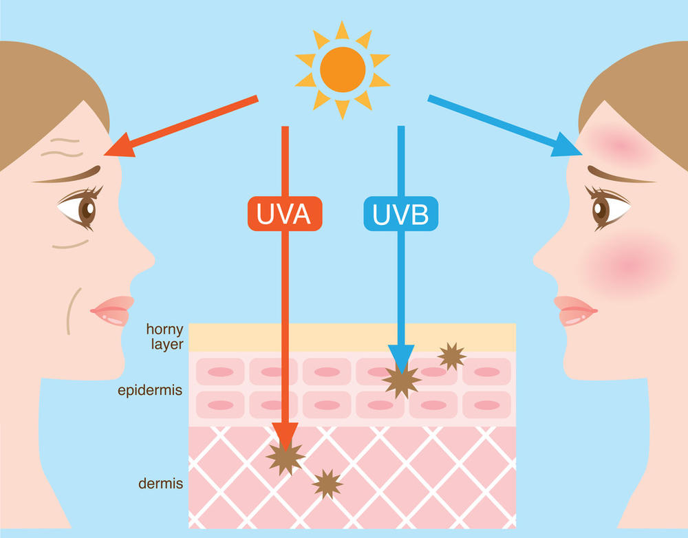 导致皮肤老化的所有外界因素中, 紫外线是最大元凶.