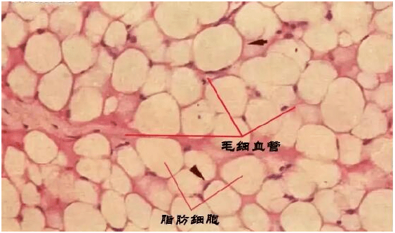 填充的脂肪会不会感觉脸上