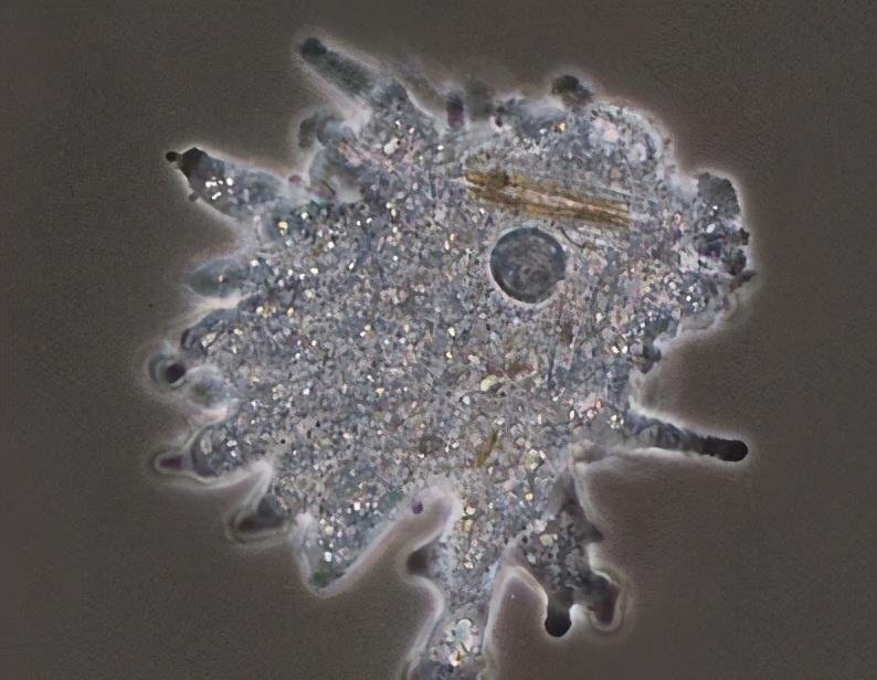原创污水处理常见微生物照片变形虫