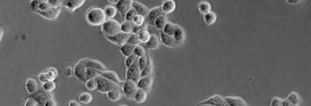 原创科学家发现:"海拉细胞"能无限分裂,不会衰老和死亡