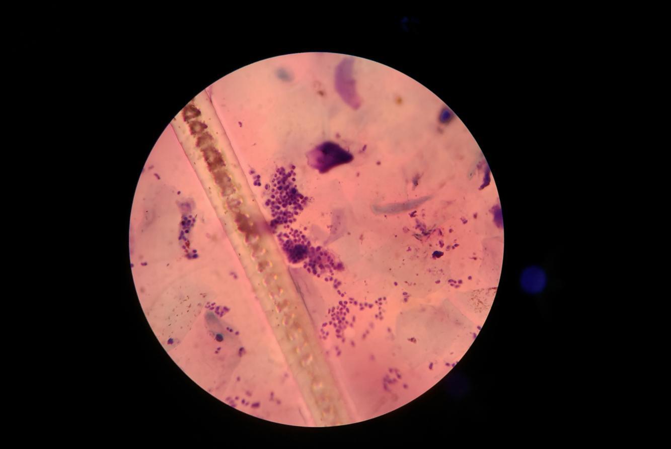 显微镜下的真菌孢子