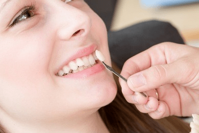瓷牙vs牙齿贴面,选择哪个效果更好?