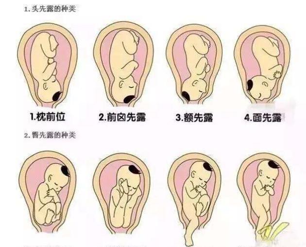 育儿说 孕期为何宝宝在肚子底下踢 越早知道越好_胎儿