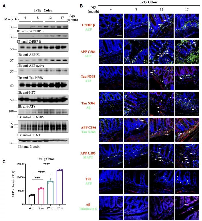ad小鼠肠道中c/ebpβ/aep通路激活水平随年龄增长而上调