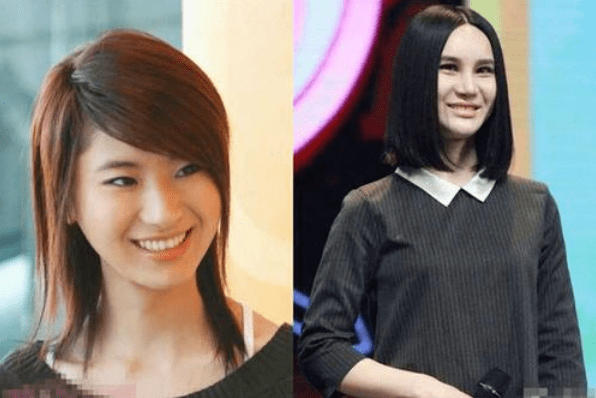 整容上瘾让人不忍直视10位整容过度的女明星他们可曾后悔