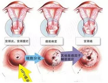 患上妇科肿瘤,身体早就发出信号!女孩们,请注意!_女性