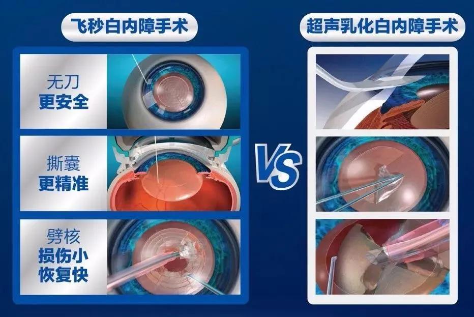 还在研究超声乳化?快来了解一下飞秒激光!