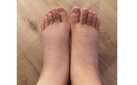 脚上若出现3个"异常",或许是重大疾病的信号,别忽视了