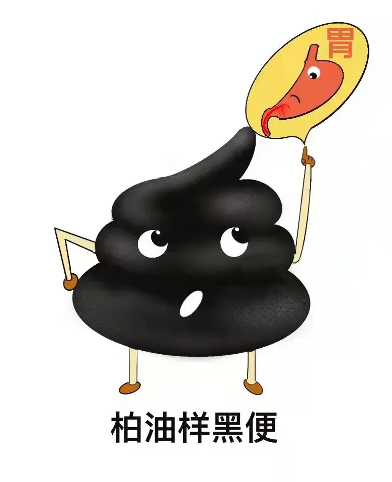 如果发现排便为黑色,呈柏油样,往往提示是上消化道出血.