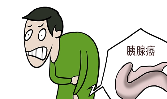 胰腺癌是一种恶性程度很高的癌症,诊断和治疗都比较困难的消化道癌变.
