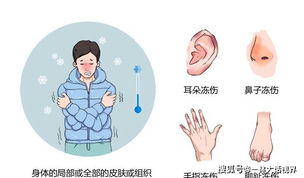冻疮与碳基元素相比,硅基元素具有更稳定的内部结构,因此科学家推测