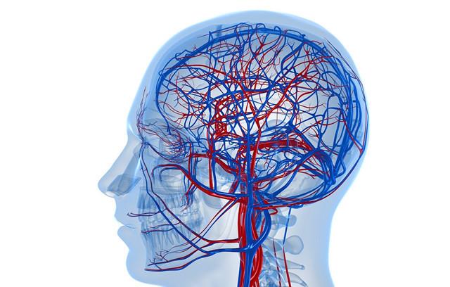 原创身体这些情况的出现或许在预示头部血管堵塞即将来临