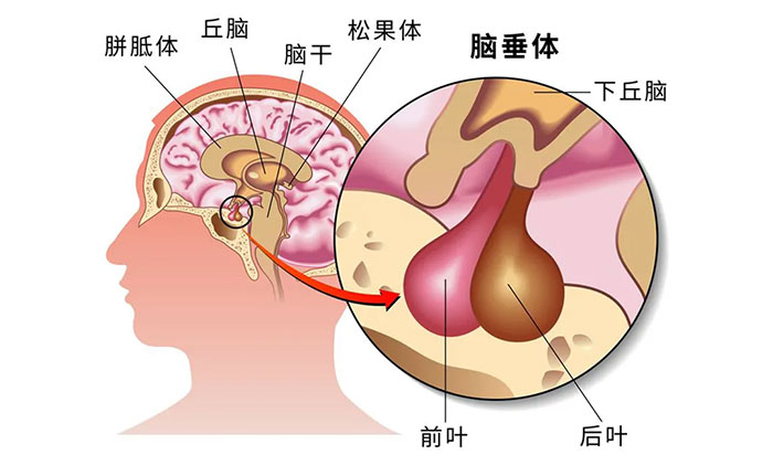 蓝十字脑科打破脑外科禁忌82岁高龄垂体瘤患者术后康复出院