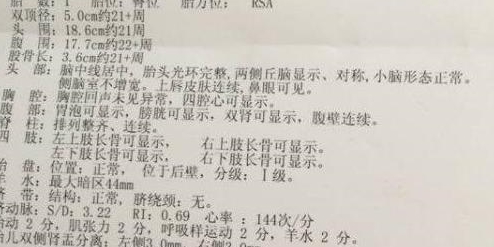 产检时若b超单上出现这5个字腹中可能是位小王子