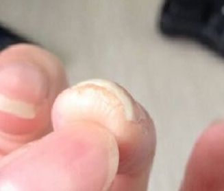 身体健康不健康,通过眼睛,声音,手,足和身材就能看出来_手指甲_关节