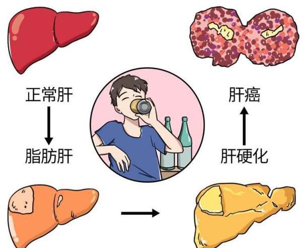 原创患有肝癌的人多半有这哪些特征是否需要定期检查