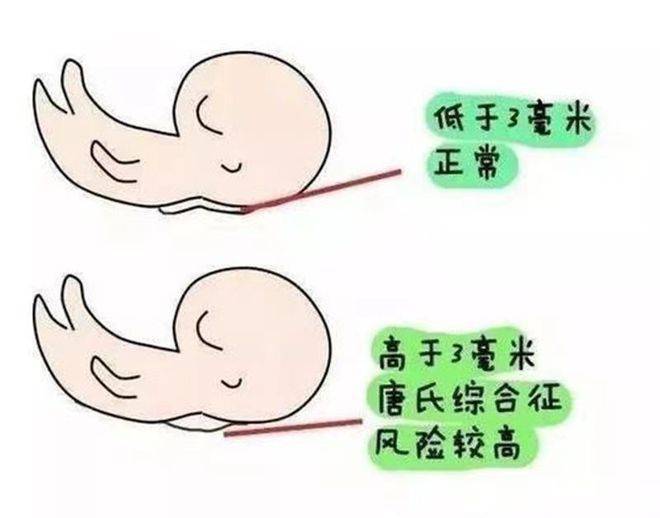 抽血,验尿—一楼e区做心电图检查—检查报告出来,到二楼a区预约b超
