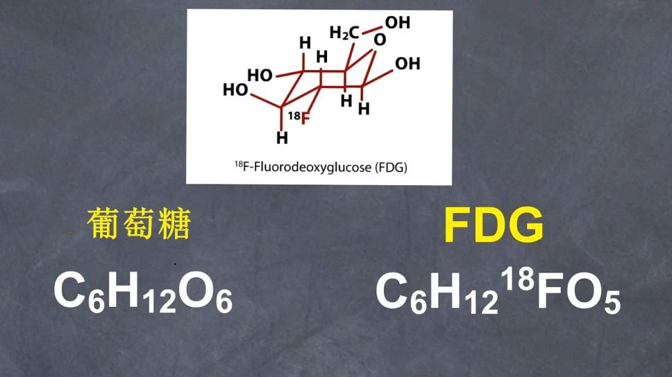 反物量的应用：正电子发射断层扫描