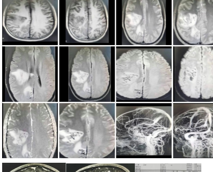 �Լ����没���͹�ע�Թ��������׶������ۺ���ح3���Ӷ�Ƭ ...