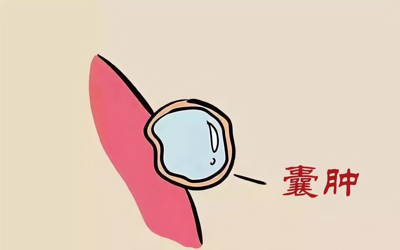 ，其实想解决这些东西也很简单，你只要弄清楚它是怎么产生的就好办了。其实无论结节也好，囊肿也罢，在中医