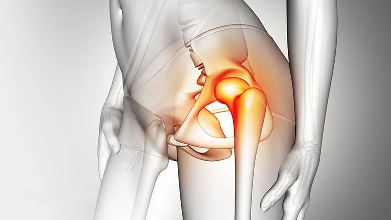 周围韧带包括股骨头韧带和髋臼韧带,它们能够保持股骨头和髋臼的位置稳