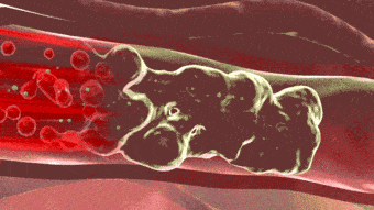 因为老公这个问题,闹离婚.