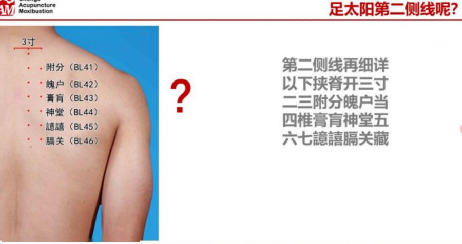 针灸排名_中医针灸图片