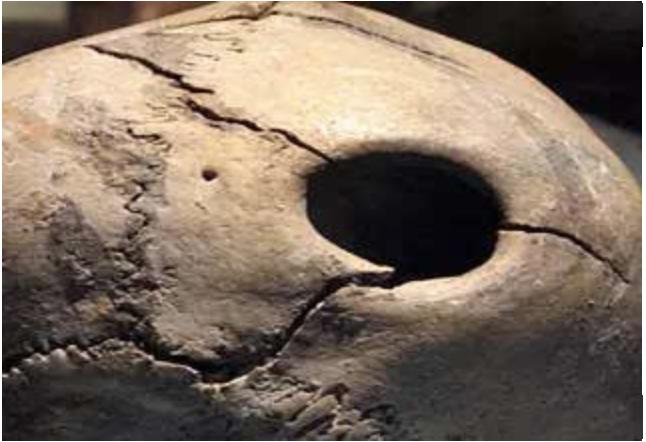 死地只有一招可以破解！脑组织被挤变形？这种快速置人于死地的危重状态