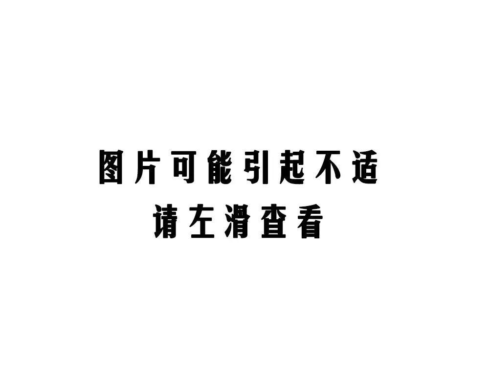 「睾丸」家有儿子一定要看又一起悲剧！男孩“蛋疼”1天致坏死