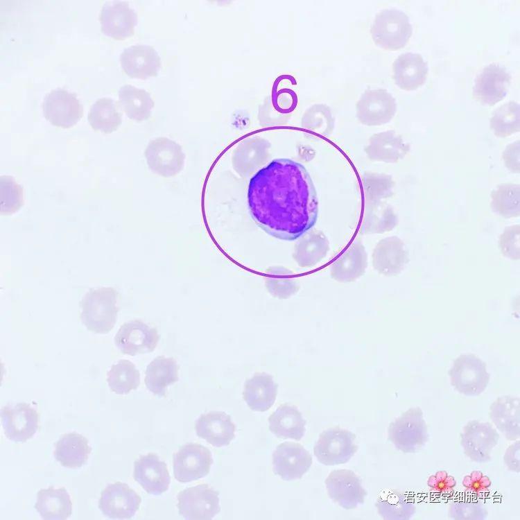 看图识细胞(第83期)_颗粒