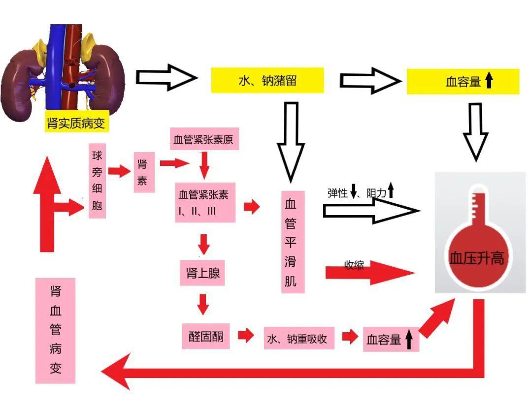 肾素低的原因 来自搜狐网