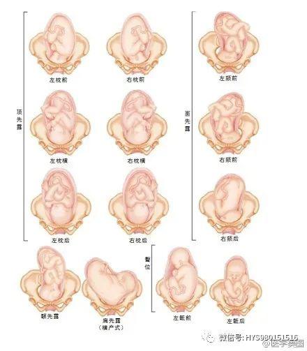 41,听胎心的位置(ps,即使位置正确,也要很耐心仔细找才能听到)42,异位