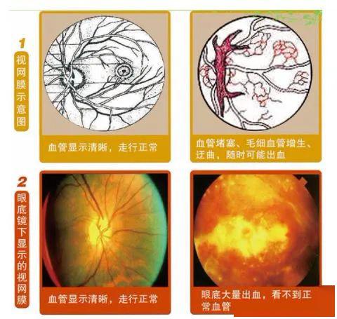 千疮百什么成语_痔.疮什么样子(2)