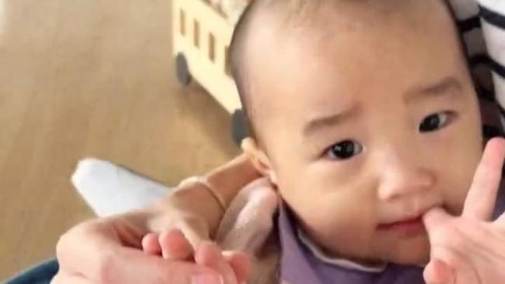 海哈金喜带女儿看病,手指脱皮眼睛斜视,是基因有问题吗?