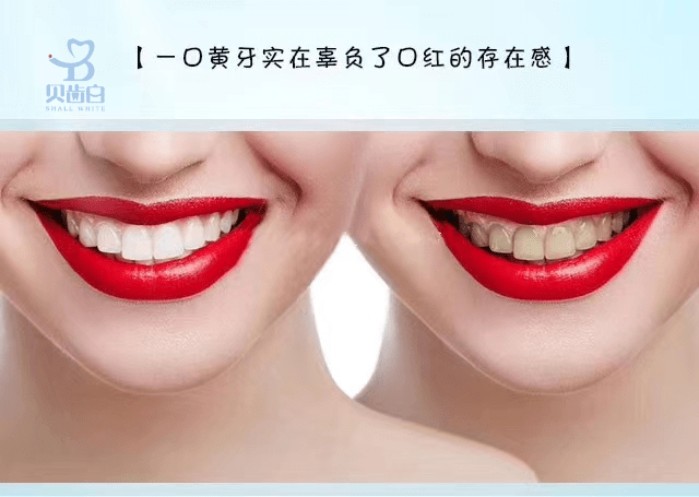 贝齿白你不知道的大白牙小知识