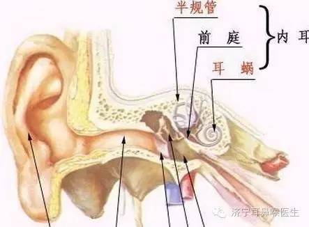 贵阳铭仁耳鼻喉医院:耳石症是耳朵里长石头了吗?