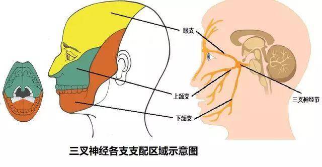 黄杏秀主任解读脸疼若伴随这几个特点就是三叉神经痛无疑了患者
