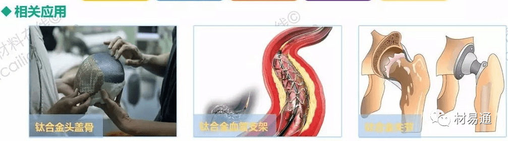 生物医用钛合金材料