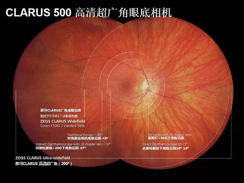安徽首台蔡司 clarus 500高清超广角眼底相机落户科视