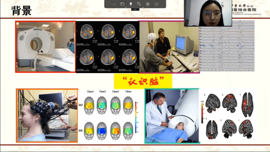 张思聪:tms-eeg在脑功能障碍中的应用【脑客中国•医疗】第20位