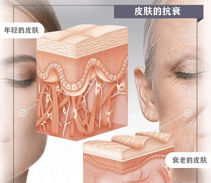 客观解析潮流抗衰项目rsfu极塑波技术原理_美容_热能_温控