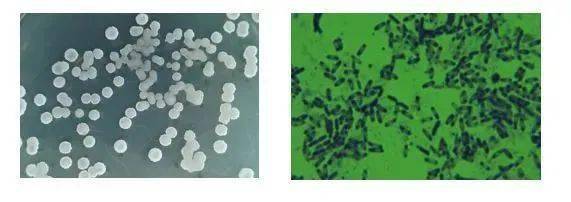 枯草芽孢杆菌到底有多神奇?