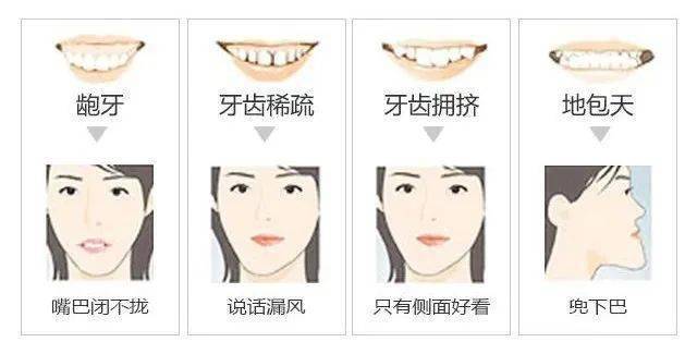 牙齿不齐影响脸型