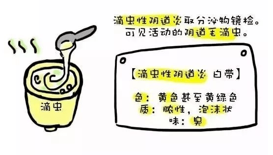 细菌性阴道病虽然没有"炎"字,但本质上也是阴道的一种炎症.