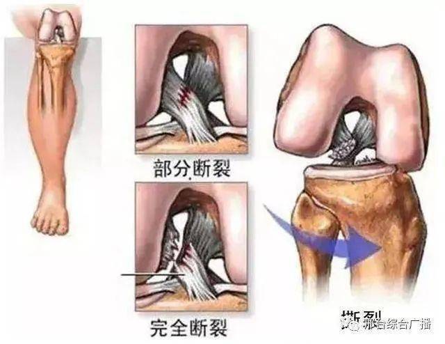 【885|名医热线】生宝宝其实很"简单"&容易被漏诊的膝关节病!