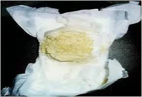 奶瓣、绿便、腹泻、便秘...宝宝的各种便便真图全解！建议收藏~